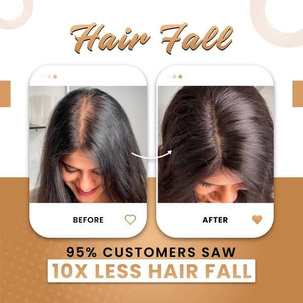 Premium Hair Oil for Hair Growth & Thickness – Anti Hair Fall Natural Oil 200ml - MK Fashionclub